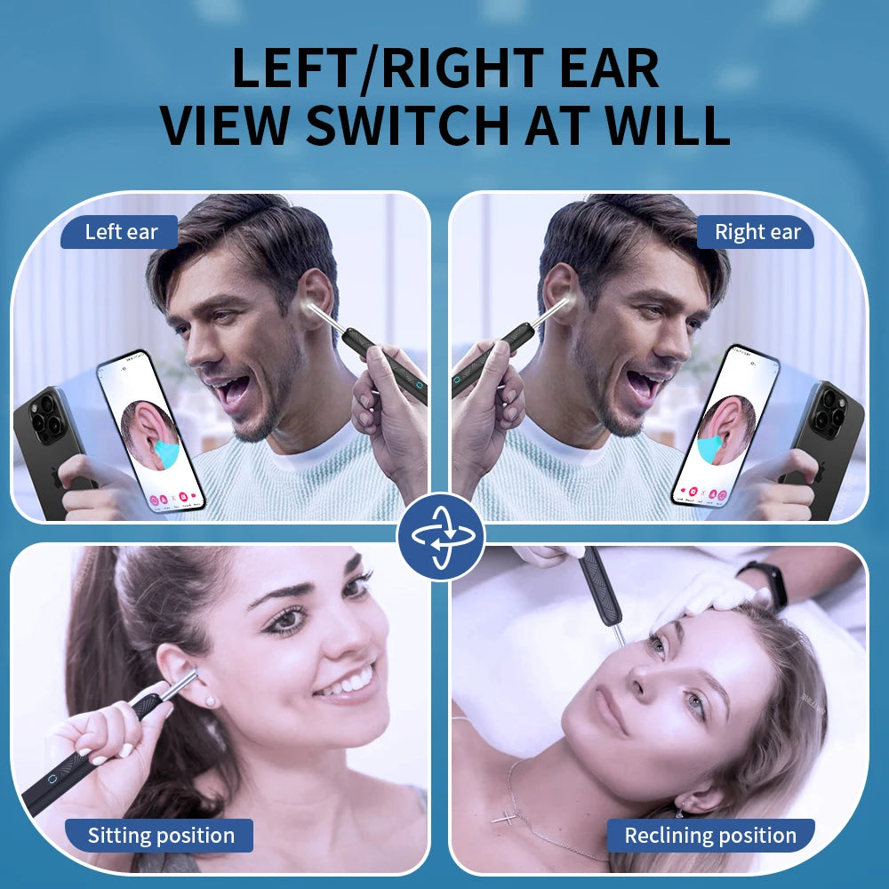  Wireless Ear Cleaner with Camera – Safe & Easy Wax Removal